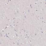 DR4 Antibody in Immunohistochemistry (Paraffin) (IHC (P))