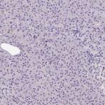 DR4 Antibody in Immunohistochemistry (Paraffin) (IHC (P))