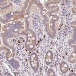 DR4 Antibody in Immunohistochemistry (Paraffin) (IHC (P))