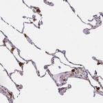 PYCARD Antibody in Immunohistochemistry (Paraffin) (IHC (P))