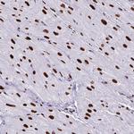 NONO Antibody in Immunohistochemistry (Paraffin) (IHC (P))