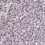 NONO Antibody in Immunohistochemistry (Paraffin) (IHC (P))