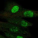 TERT Antibody in Immunocytochemistry (ICC/IF)