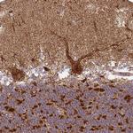 MT-CO2 Antibody in Immunohistochemistry (Paraffin) (IHC (P))