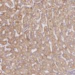 MT-CO2 Antibody in Immunohistochemistry (Paraffin) (IHC (P))