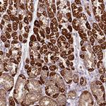 MT-CO2 Antibody in Immunohistochemistry (Paraffin) (IHC (P))