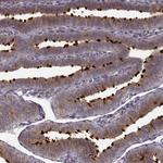 MTR Antibody in Immunohistochemistry (Paraffin) (IHC (P))