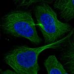 RABIF Antibody in Immunocytochemistry (ICC/IF)