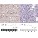 WNT10B Antibody