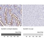 SGLT1 Antibody