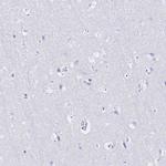 SGLT1 Antibody in Immunohistochemistry (Paraffin) (IHC (P))