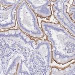 SGLT1 Antibody in Immunohistochemistry (Paraffin) (IHC (P))