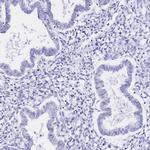 SGLT1 Antibody in Immunohistochemistry (Paraffin) (IHC (P))