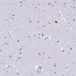 CD43 Antibody in Immunohistochemistry (Paraffin) (IHC (P))