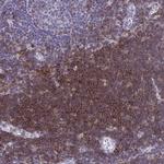 CD43 Antibody in Immunohistochemistry (Paraffin) (IHC (P))