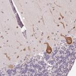 DTX1 Antibody in Immunohistochemistry (Paraffin) (IHC (P))