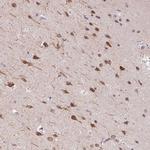 DTX1 Antibody in Immunohistochemistry (Paraffin) (IHC (P))