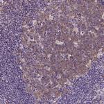 DTX1 Antibody in Immunohistochemistry (Paraffin) (IHC (P))