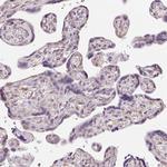 DTX1 Antibody in Immunohistochemistry (Paraffin) (IHC (P))