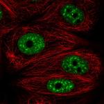 UAP56 Antibody in Immunocytochemistry (ICC/IF)