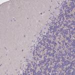 UAP56 Antibody in Immunohistochemistry (Paraffin) (IHC (P))