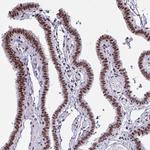 UAP56 Antibody in Immunohistochemistry (Paraffin) (IHC (P))