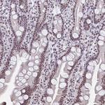 UAP56 Antibody in Immunohistochemistry (Paraffin) (IHC (P))