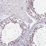 UAP56 Antibody in Immunohistochemistry (Paraffin) (IHC (P))