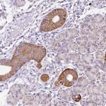 PPAP2C Antibody in Immunohistochemistry (Paraffin) (IHC (P))