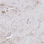 TLX Antibody in Immunohistochemistry (Paraffin) (IHC (P))