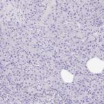 TLX Antibody in Immunohistochemistry (Paraffin) (IHC (P))