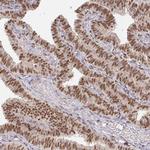 MEIS1 Antibody in Immunohistochemistry (Paraffin) (IHC (P))