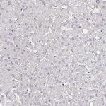 MEIS1 Antibody in Immunohistochemistry (Paraffin) (IHC (P))