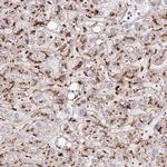 FUCA1 Antibody in Immunohistochemistry (Paraffin) (IHC (P))