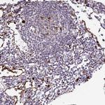 FUCA1 Antibody in Immunohistochemistry (Paraffin) (IHC (P))