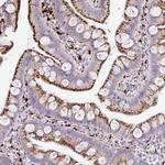 FUCA1 Antibody in Immunohistochemistry (Paraffin) (IHC (P))