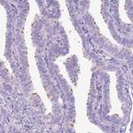 DNAH11 Antibody in Immunohistochemistry (Paraffin) (IHC (P))