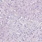 DNAH11 Antibody in Immunohistochemistry (Paraffin) (IHC (P))