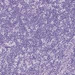 DNAH11 Antibody in Immunohistochemistry (Paraffin) (IHC (P))