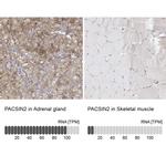 PACSIN2 Antibody