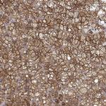 PACSIN2 Antibody in Immunohistochemistry (Paraffin) (IHC (P))