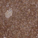 PACSIN2 Antibody in Immunohistochemistry (Paraffin) (IHC (P))