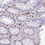 HK3 Antibody in Immunohistochemistry (Paraffin) (IHC (P))