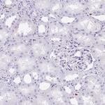 HK3 Antibody in Immunohistochemistry (Paraffin) (IHC (P))