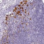 HK3 Antibody in Immunohistochemistry (Paraffin) (IHC (P))