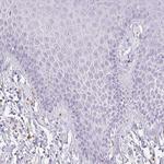 HK3 Antibody in Immunohistochemistry (Paraffin) (IHC (P))