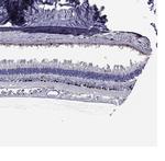 AP2 alpha Antibody in Immunohistochemistry (Paraffin) (IHC (P))