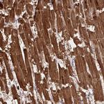 Cardiac Troponin C Antibody in Immunohistochemistry (Paraffin) (IHC (P))