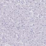 Cardiac Troponin C Antibody in Immunohistochemistry (Paraffin) (IHC (P))