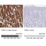 Cardiac Troponin C Antibody